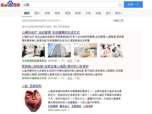 鯰魚來了 百度你是那只爭氣的沙丁魚嗎？ 